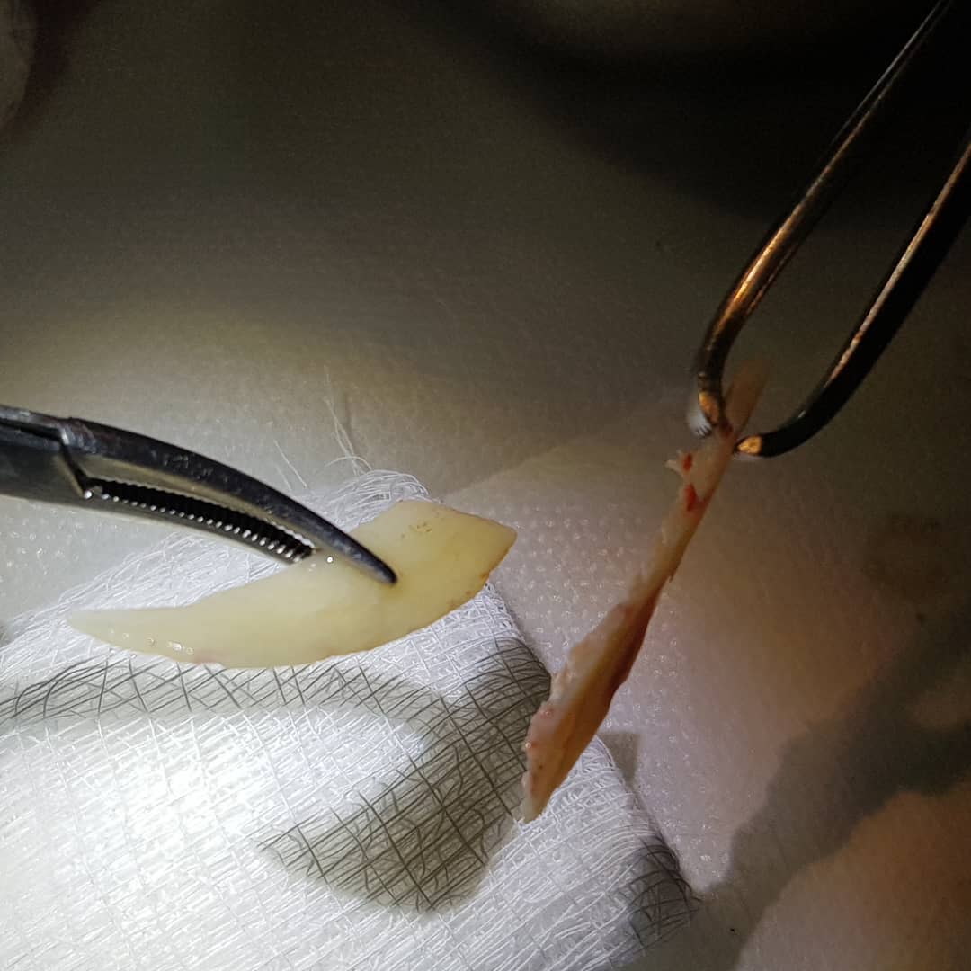 Maxillofacial Buco Surgery implantology